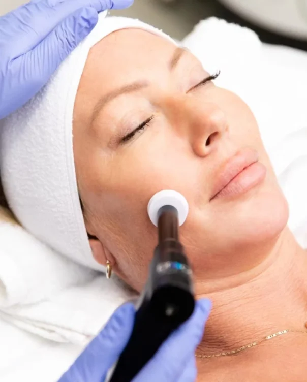 Procell_Therapies_Microchanneling-2