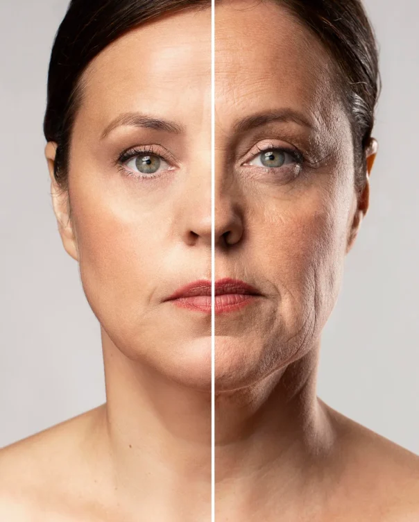 Skin tightening treatment (2)